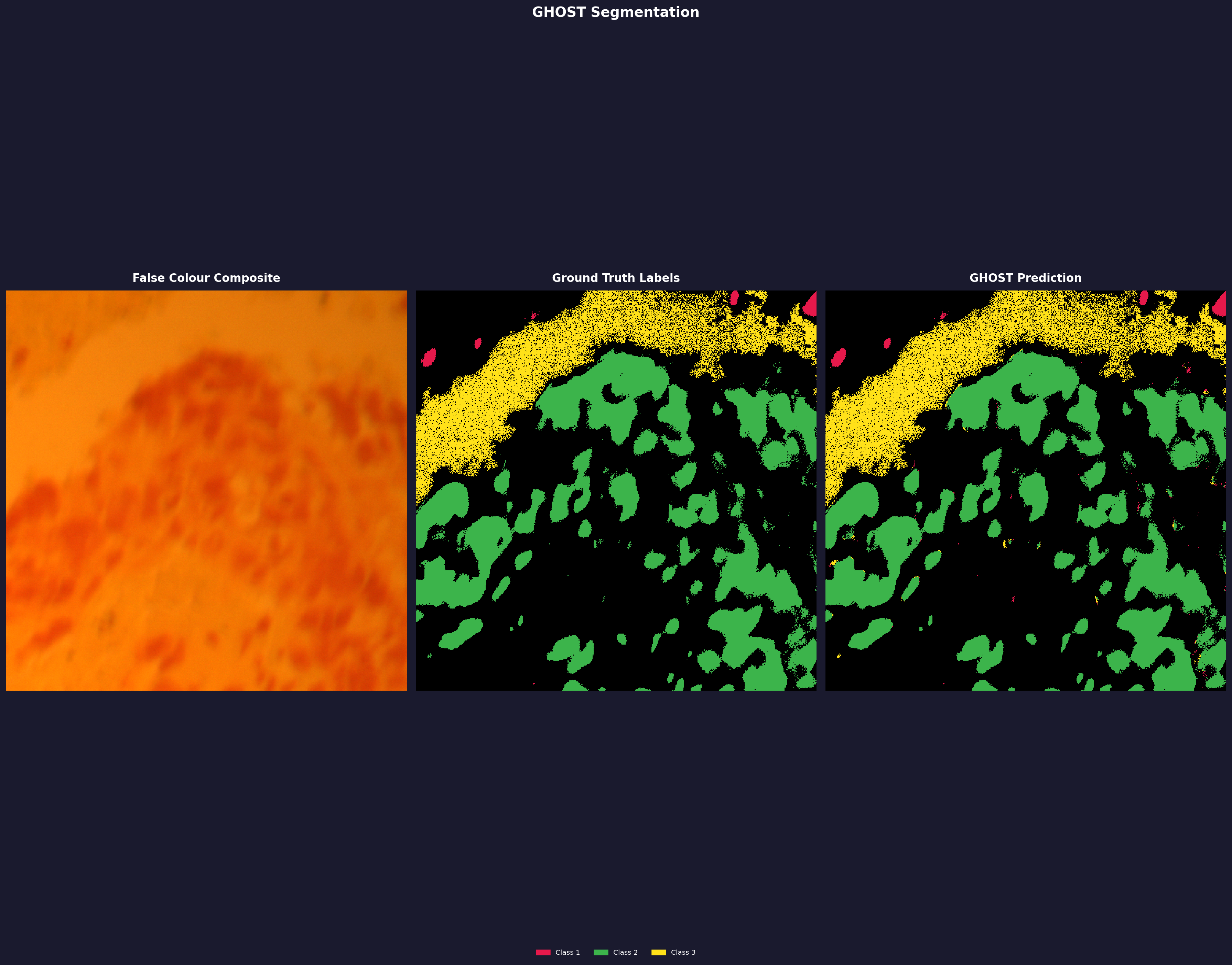 LUSC Lung Cancer Segmentation